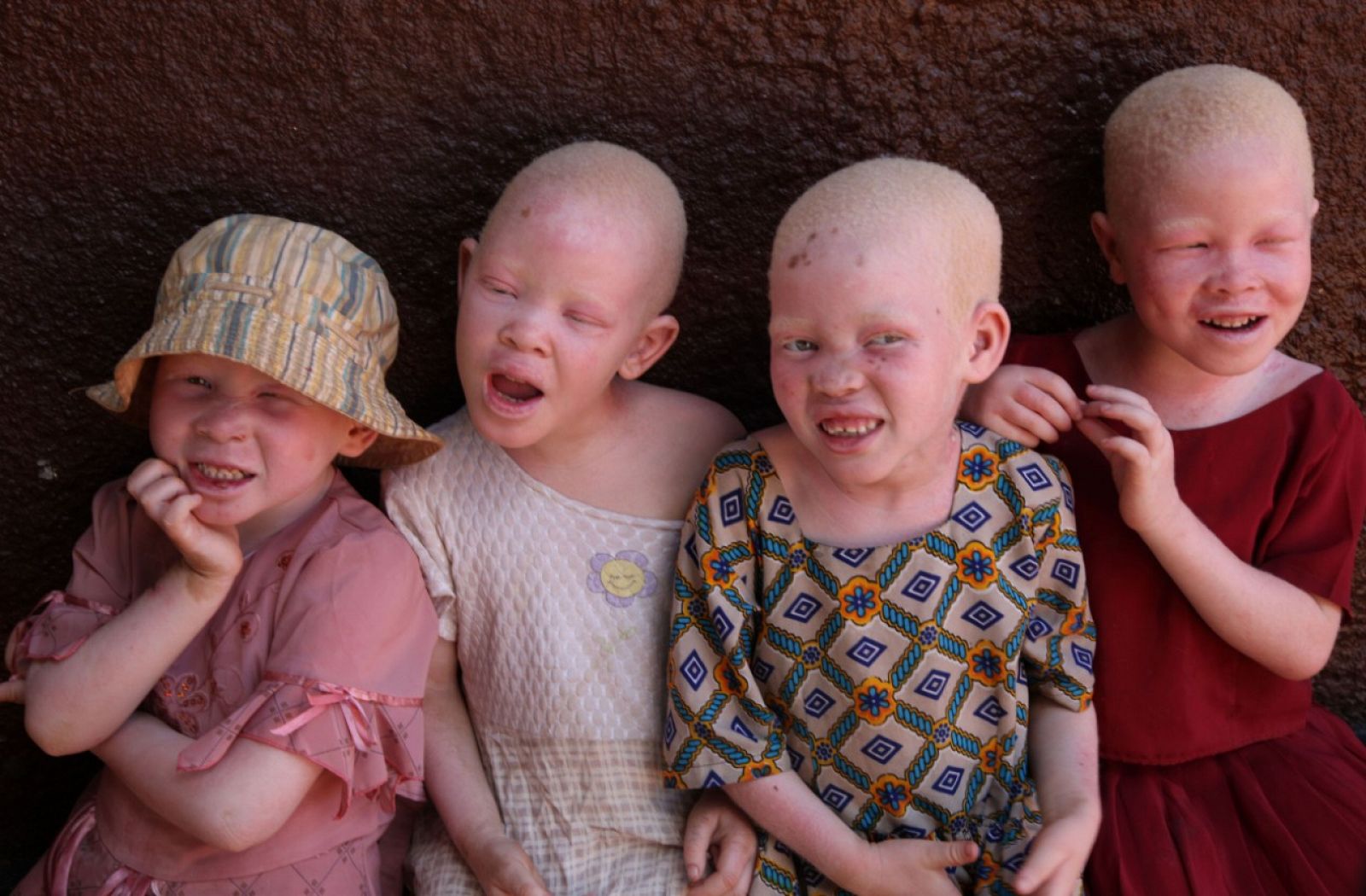 Albinos en Tanzania. Foto de Ana Palacios Albinos en Tanzania. Foto de Ana Palacios