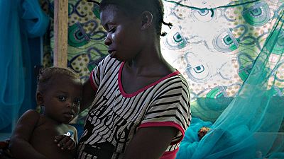 Fatouma, de dos años y afectada por la malaria, reposa en brazos de su madre tras recibir una transfusión sanguínea que palie la anemia causada por la enfermedad