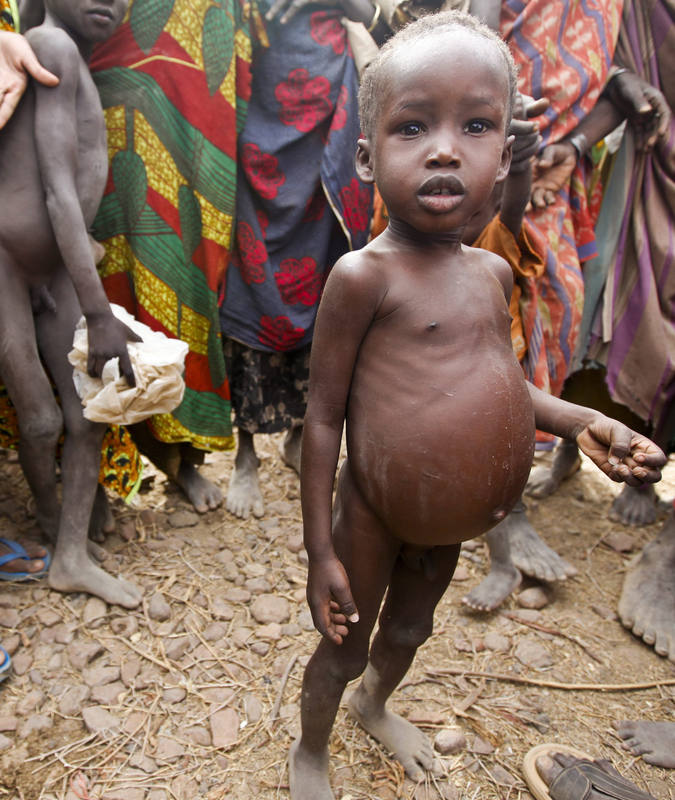 Los efectos de las sequías provocadas por El Niño pueden ser devastadores para la población infantil de ciertos países africanos.