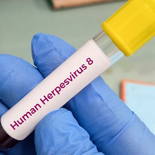 La prolífica familia de los herpesvirus