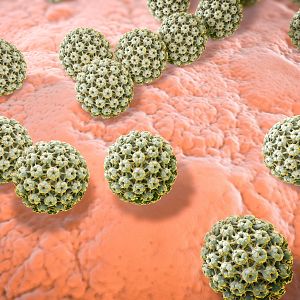 A golpe de bit en Radio 5 - A golpe de bit en Radio 5 -  Virus del Papiloma Humano - 13/03/24 - Escuchar ahora