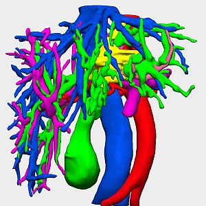 Con bata blanca - Con bata blanca - Robot y humano: el mejor equipo de cirujanos - 19/04/24 - escuchar ahora