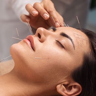 La acupuntura: una técnica milenaria