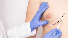 Reportajes Emisoras - Toledo - Cáncer de mama en hombres - 02/05/24