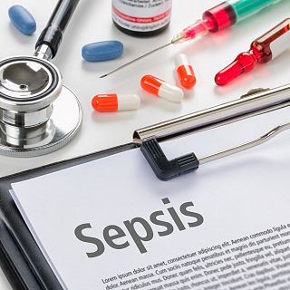 Sepsis, ciencia e investigación