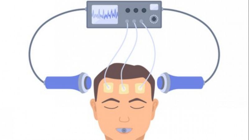 Las mañanas de RNE - Mamen Asencio - Electroshock: la terapia estigmatizada usada para la depresión - Escuchar ahora