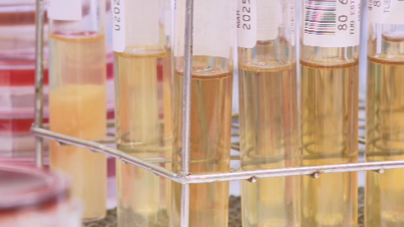 El 60% de les infeccions urinàries intrahospitalàries les provoquen ...