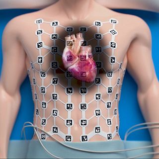 Primer sistema no invasivo de mapeo global del corazón