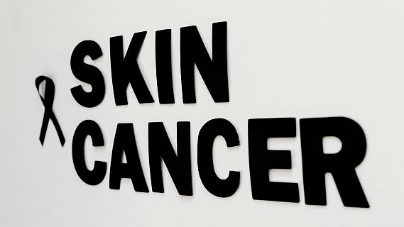 Dia Mundial del Melanoma: alerta sobre el cncer de pell