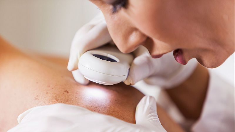 Sonia Pérez, afectada por el cáncer de piel: "está controlado, pero está ahí” - Escuchar ahora