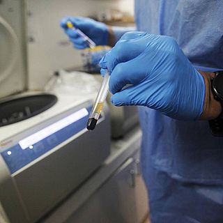 EEUU aprueba la primera inyección semestral para prevenir el VIH