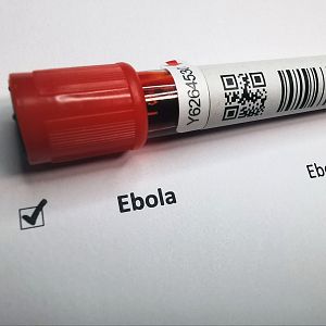 África hoy - Nuevo brote de ébola causa 16 muertos en RDC - África hoy | Escuchar