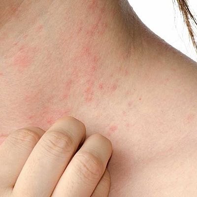 Emprendimiento y tecnología contra las enfermedades cutáneas - A golpe de bit | Escuchar