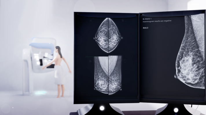 Progreso clave en el tratamiento del cáncer de mama HER2+ - A golpe de bit | Escuchar