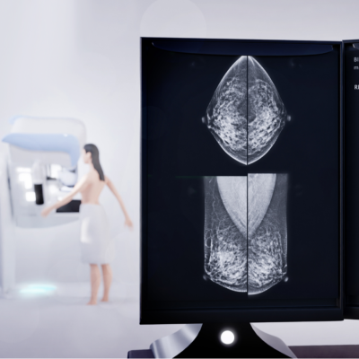 Progreso clave en el tratamiento del cáncer de mama HER2+ - A golpe de bit | Escuchar