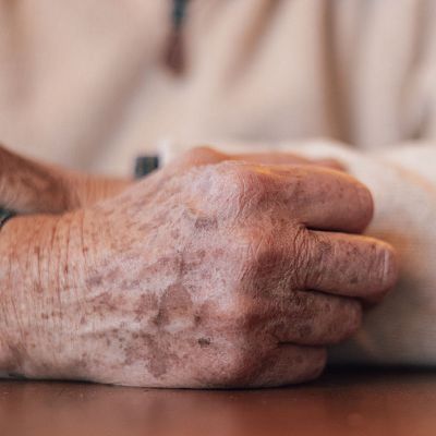 Los procesos biológicos del envejecimiento, a debate - A golpe de bit | Escuchar