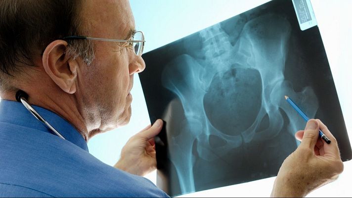 Osteoporosis: de los viejos mitos a los nuevos retos - Marca España | Escuchar