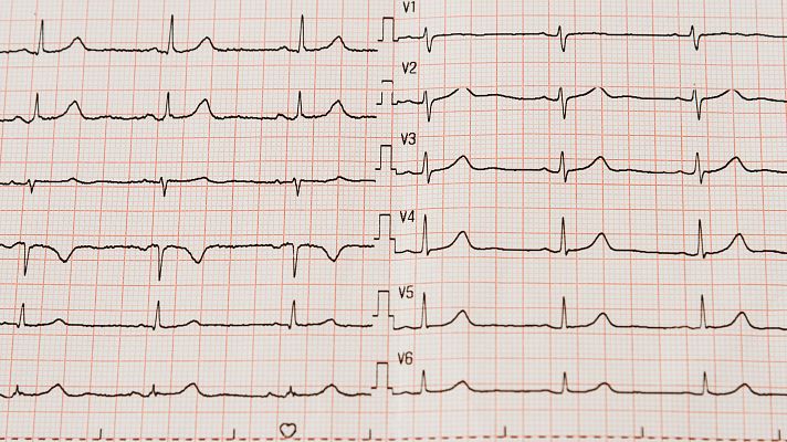 ¿España goza de buena salud cardiovascular? - Marca España | Escuchar