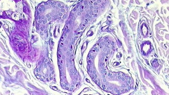 El modelo que mejora el estudio de la enfermedad de Lafora - A golpe de bit | Escuchar