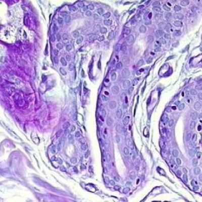 El modelo que mejora el estudio de la enfermedad de Lafora - A golpe de bit | Escuchar