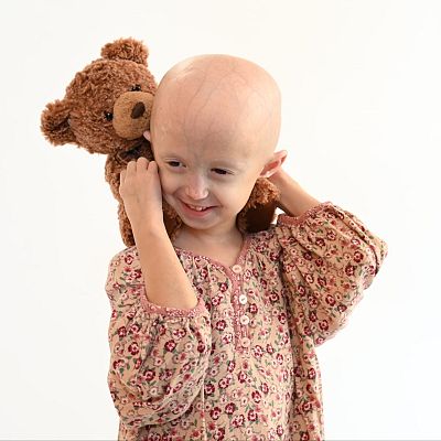 Memoria de delfín - Progeria: envejecimiento prematuro de los niños - escuchar ahora