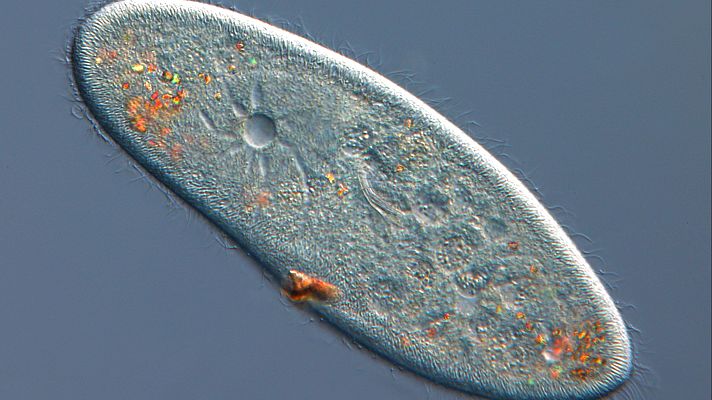 La vida tuvo que hacer un cambio de sistema operativo - A golpe de bit | Escuchar