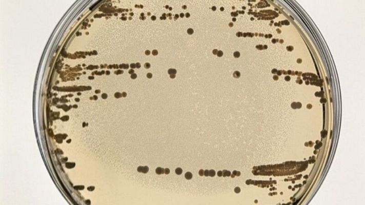 Resistencia a antibióticos: hallada nueva clave en plásmidos - A golpe de bit | Escuchar