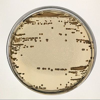 Resistencia a antibióticos: hallada nueva clave en plásmidos - A golpe de bit | Escuchar