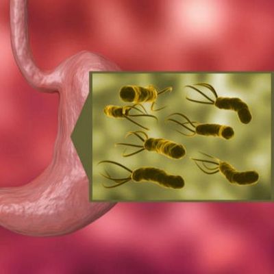 Historia y ciencia por un tubo - El científico que se convirtió en cobaya - 20/04/26 - Escuchar ahora