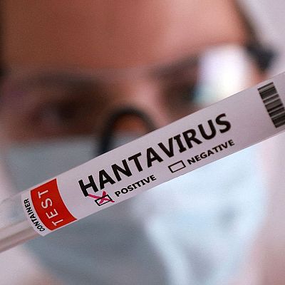 Hantavirus y otras amenazas víricas emergentes - Marca España | Escuchar