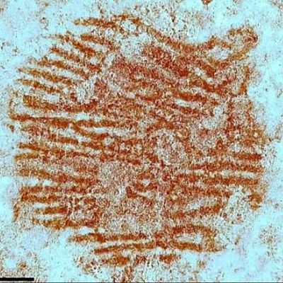 The fingerprint of Segovia - España en la historia | Escuchar