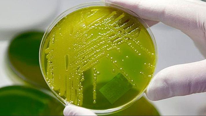 Entrenar bacterias para que coman bioplásticos - A golpe de bit | Escuchar