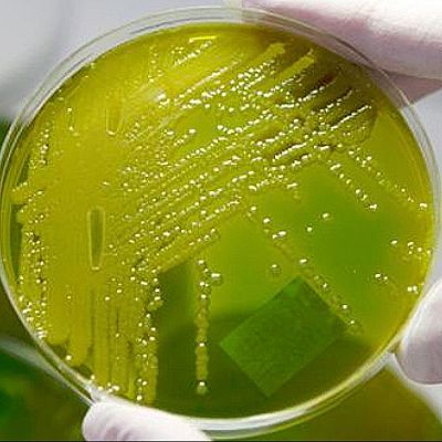 Entrenar bacterias para que coman bioplásticos - A golpe de bit | Escuchar