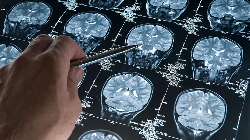 English Language Broadcast - Using AI to fight dementia
