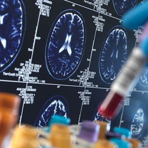 Marca España - Una mano con guante azul señala una resonancia magnética de un cerebro humano en una pantalla retroiluminada con códigos técnicos, en un entorno de investigación médica.