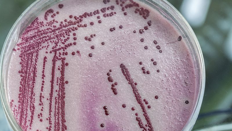 El canto del grillo - La tuberculosis: causa, síntoma y cura - Escuchar ahora