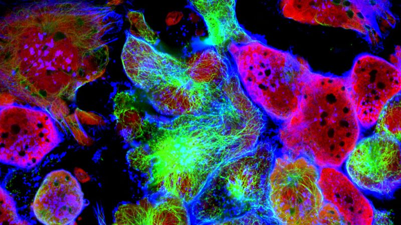 Esto me suena. Las tardes del Ciudadano García - Las células salvavidas de Henrietta Lacks - Escuchar ahora