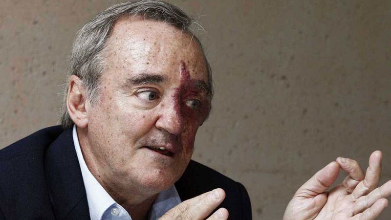  Las mañanas de RNE - Mariano Barbacid: "La única actividad que realmente causa cáncer es fumar" - Escuchar ahora