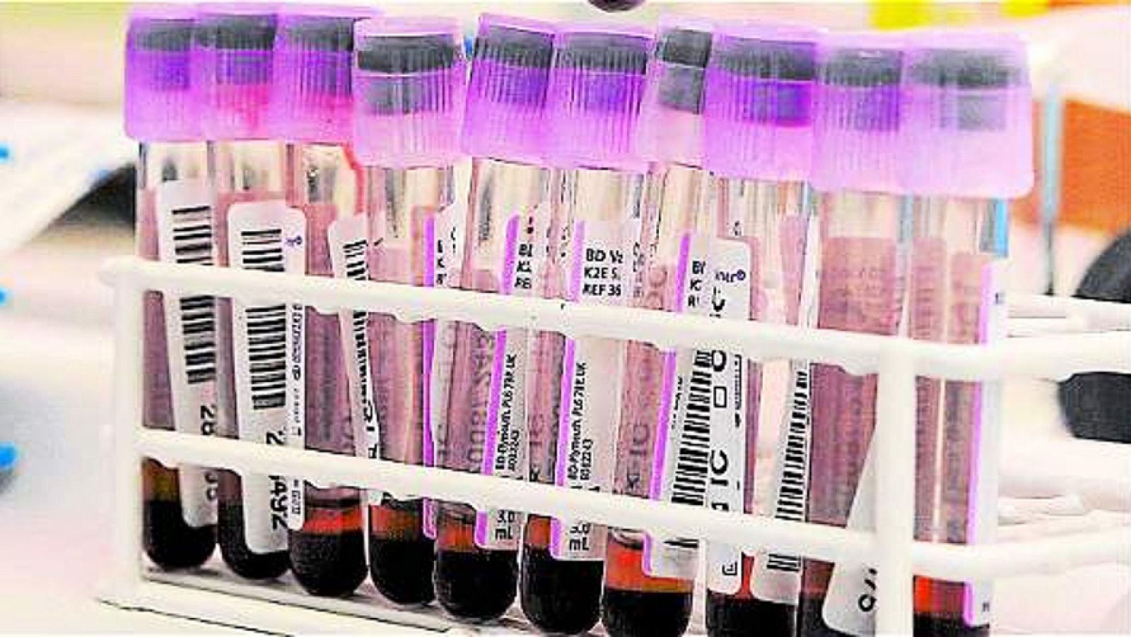 Deporte limpio - Instituciones contra el dopaje - 08/08/17 - Escuchar ahora 