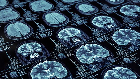 Descubriendo capacidades