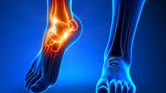 Radio 5 Actualidad - Radio 5 Actualidad - Investigadores españoles descubren un nuevo ligamento en el tobillo - 30/10/18 - Escuchar ahora