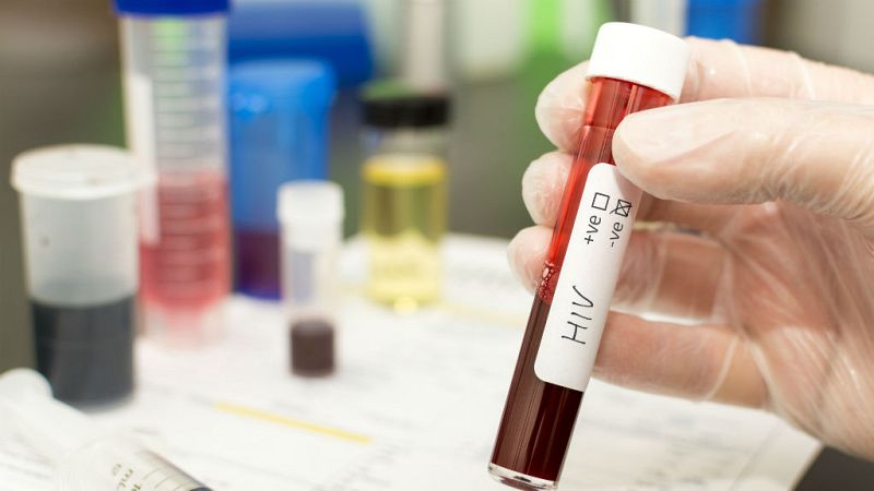 oletines RNE - Un paciente con VIH, segundo adulto en el mundo en librarse del virus - Escuchar ahora 