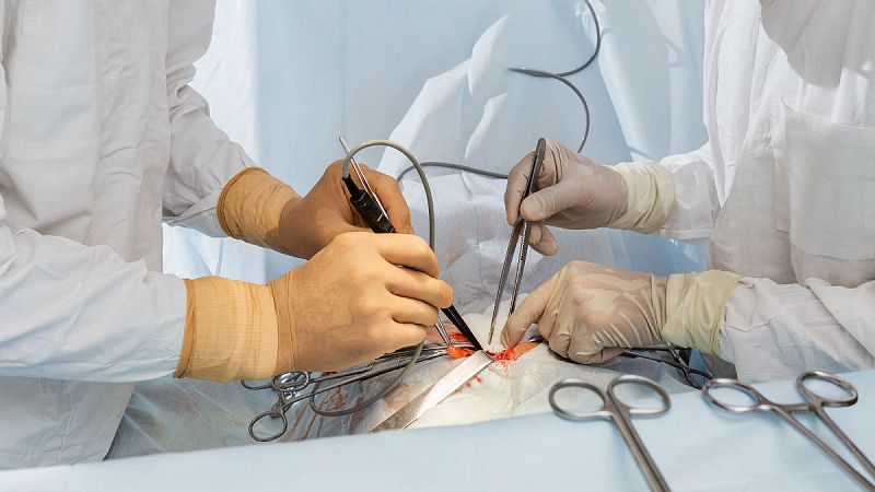 14 horas - El trasplante de útero, un reto que plantea dudas - Escuchar ahora