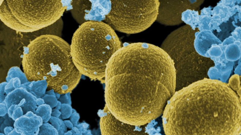 Plan hospitalario contra las bacterias resistentes - Escuchar ahora