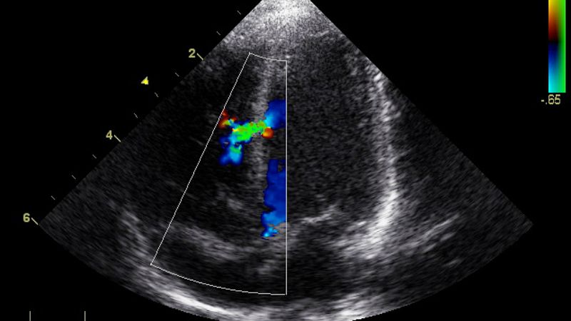 A su salud - Ecocardiograma - 01/05/19 - Escuchar ahora