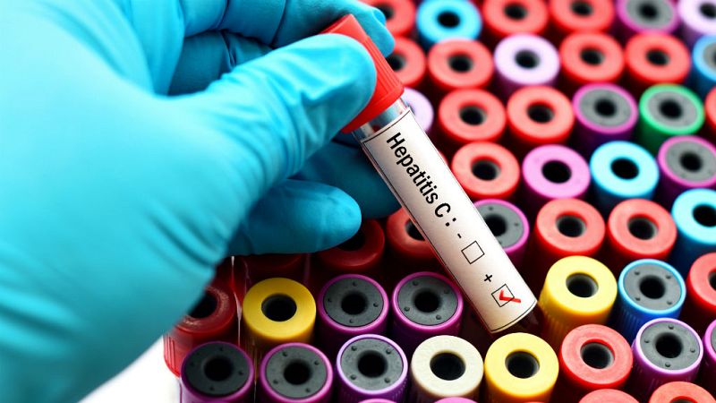  Las mañanas de RNE con Iñigo Alfonso - "Estamos cerca de algo histórico: eliminar la Hepatitis C de personas con VIH" - escuchar ahora