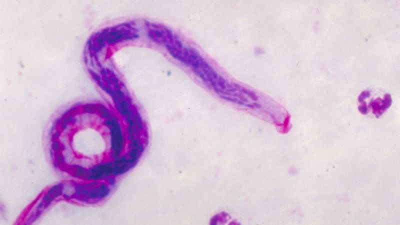 El arca de Noé - Filariasis - 6/7/19 - Escuchar ahora