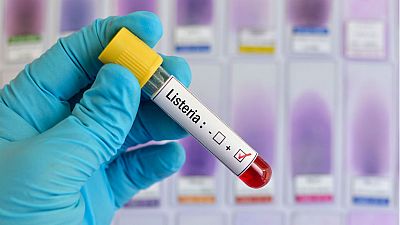 14 Horas - Registrados 40 casos de listeriosis en Andalucía  - Escuchar ahora