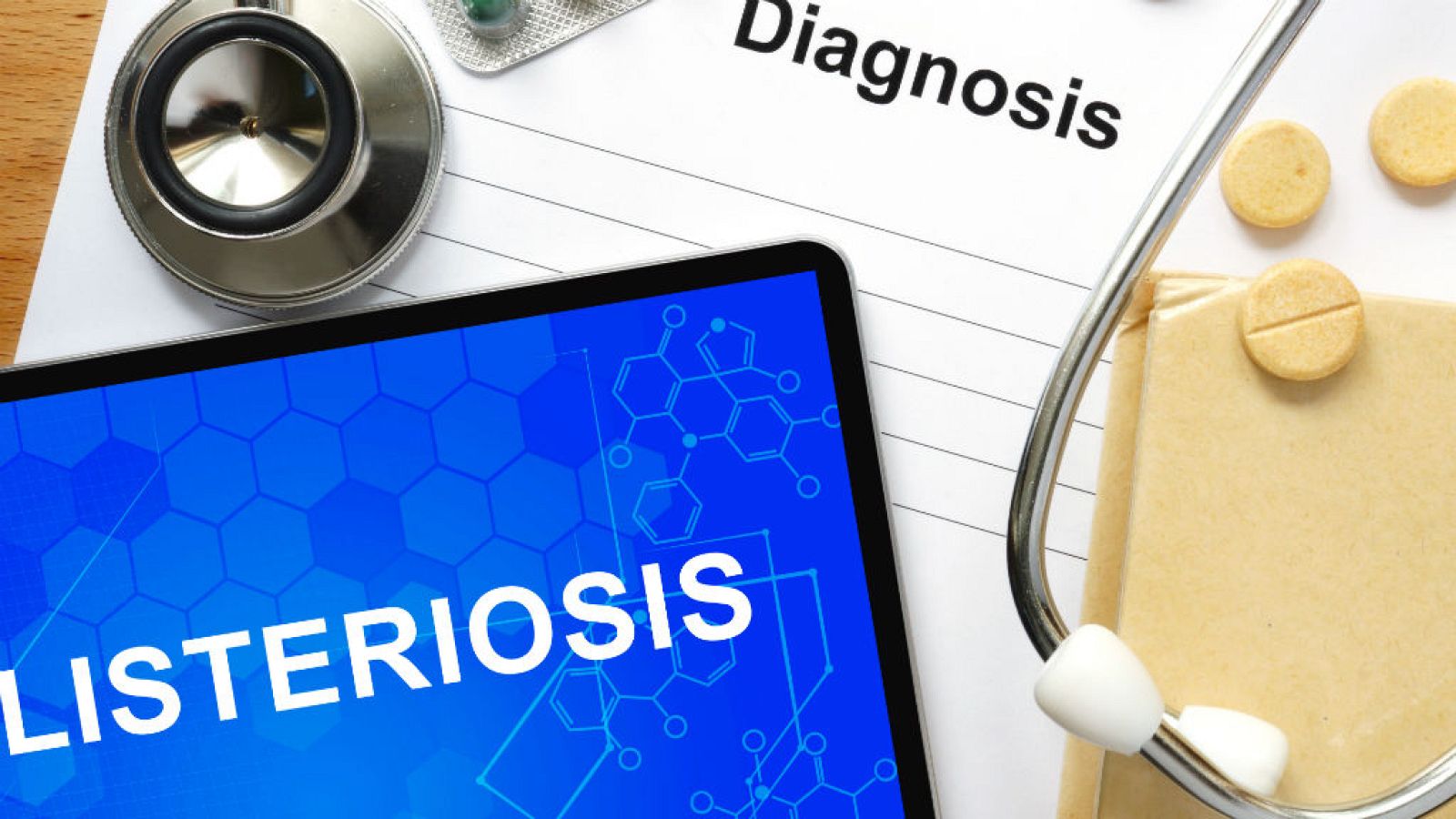  Las mañanas de RNE con Íñigo Alfonso - Se confirma un caso de listeriosis en Extremadura - Escuchar ahora