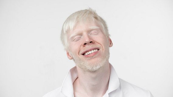 Tres mundos, solidaridad